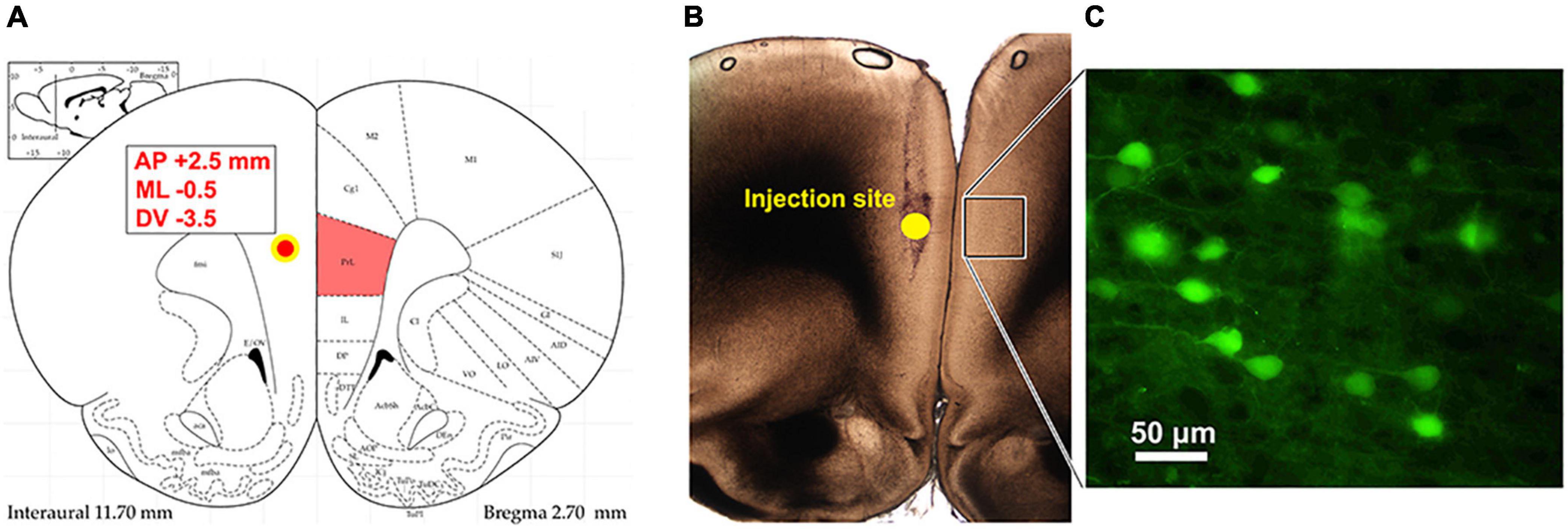 Impaired muscarinic modulation of the rat prelimbic cortex in neuropathic pain is sexually dimorphic and associated with cold allodynia